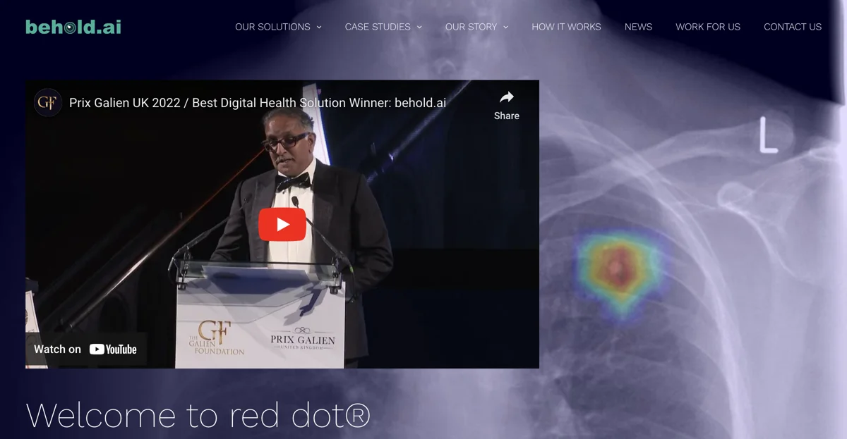 Behold.ai – Chẩn Đoán Y Tế AI Nhanh Chóng Để Cải Thiện Chăm Sóc Bệnh Nhân